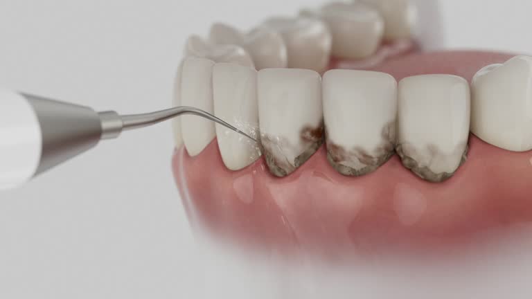 Trusted Emergency Dentist service in Lockport Heights, IL - Dentist Open Now